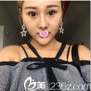 在北京知音做眼綜合第23天