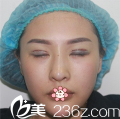 金陽洙院長(zhǎng)給我手術(shù)當(dāng)天