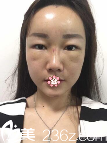 剛做完填充 剛做完填充