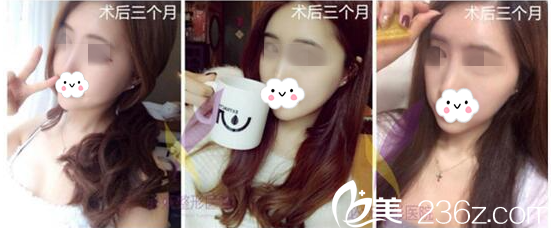 術(shù)后三個(gè)月