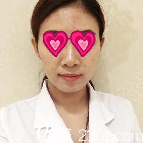 面部祛痘美膚術后一周效果 面部祛痘美膚術后一周效果