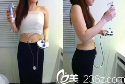 假體隆胸手術后一周