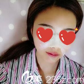 鼻綜合整形術后當天照 鼻綜合整形術后當天照