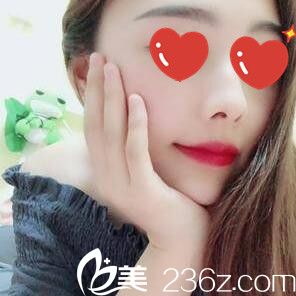 做鼻綜合術后一周拆線 做鼻綜合術后一周拆線