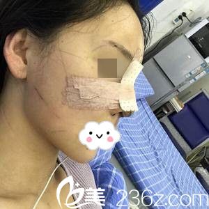 術(shù)后當(dāng)天的我 術(shù)后當(dāng)天的我