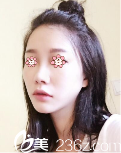 我是塌鼻子 我是塌鼻子