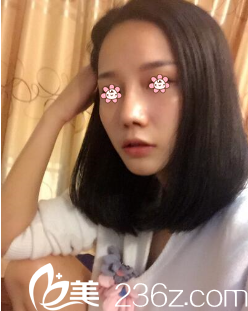 重慶美侖美奐姬廣翰隆鼻好嗎 重慶美侖美奐姬廣翰隆鼻好嗎