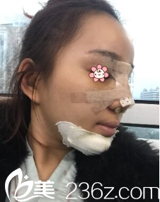 <!--<i data=20240703-sp></i>-->醫(yī)生給我做完手術(shù)后第三天