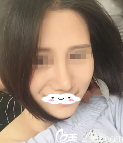 手術(shù)后第23天