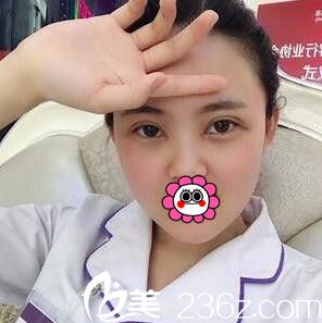 3D媚眼綜合術(shù)術(shù)后一周恢復(fù)效果 3D媚眼綜合術(shù)術(shù)后一周恢復(fù)效果