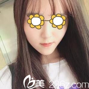 快看我找韓國首爾整形外科韓相百做的下頜角整形術(shù)后一個(gè)月效果怎么樣？