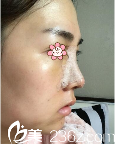 鄭鎬勛院長給我做完手術(shù)后第六天 鄭鎬勛院長給我做完手術(shù)后第六天