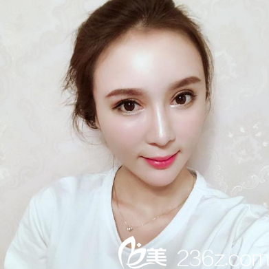 深圳博愛<!--<i data=20240703-sp></i>-->做的雙眼皮隆鼻和脂肪填充<span style=