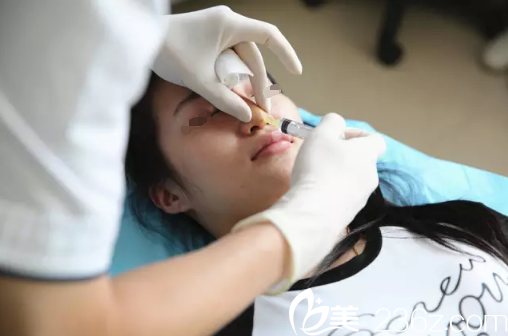 注射玻尿酸溶解酶溶解鼻內材料