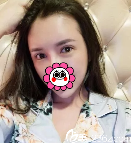 在北京壹加壹找丁洪如做眼修復(fù)第21天樣子 在北京壹加壹找丁洪如做眼修復(fù)第21天樣子