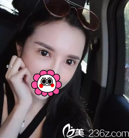 北京壹加壹眼修復(fù)修復(fù)案例 北京壹加壹眼修復(fù)修復(fù)案例