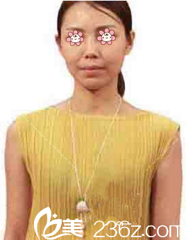 術(shù)前的我 術(shù)前的我