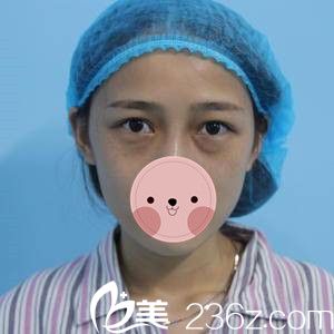 手術(shù)前的我 手術(shù)前的我