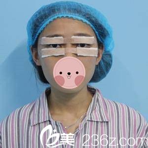 祛眼袋手術(shù)當(dāng)天 祛眼袋手術(shù)當(dāng)天