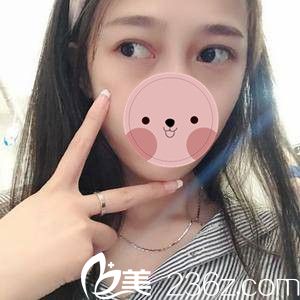 祛眼袋術(shù)后一周 祛眼袋術(shù)后一周