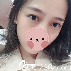 術(shù)后第十天 術(shù)后第十天