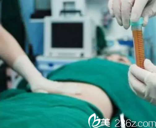 在北京壹加壹做吸脂手術(shù)使樣子 在北京壹加壹做吸脂手術(shù)使樣子