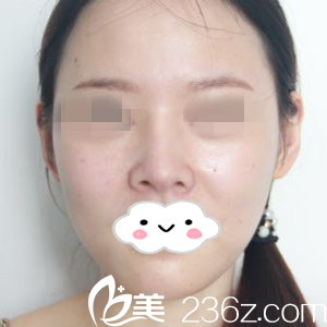 手術(shù)前的我 手術(shù)前的我