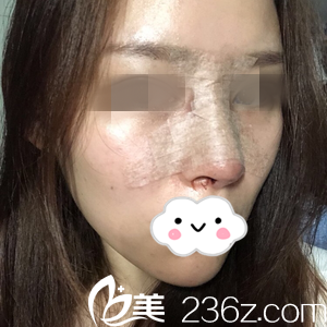 手術(shù)當天 手術(shù)當天