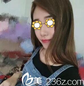 自體脂肪填充全臉術(shù)后半個月<span style= 自體脂肪填充全臉術(shù)后半個月<span style=