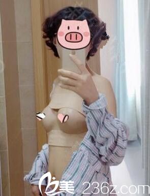 術(shù)后四天假體隆胸恢復(fù)中