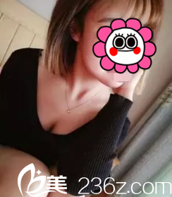 23天恢復(fù)后胸部脂肪吸收一些