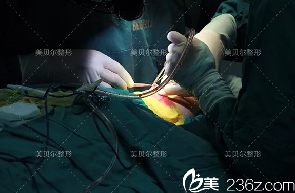 鼻綜合整形手術(shù)中 鼻綜合整形手術(shù)中