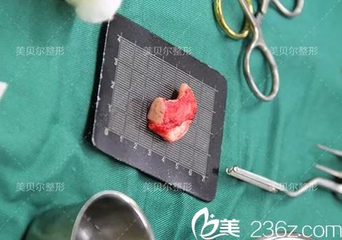 取出備用的肋軟骨材料 取出備用的肋軟骨材料