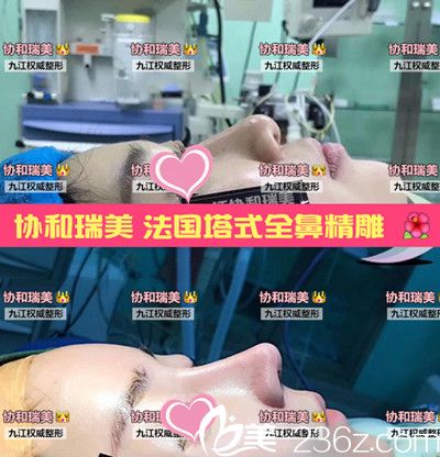 九江星瑞美案例