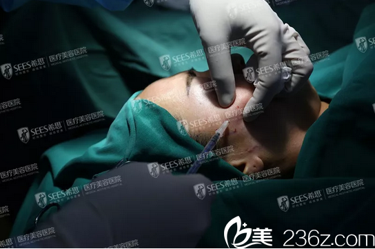 線雕提升術(shù)前打麻藥