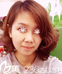 術(shù)前的我 術(shù)前的我