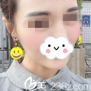 術(shù)后第14天 術(shù)后第14天