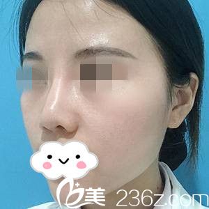 術(shù)后第二天 術(shù)后第二天