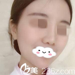 術(shù)后一周 術(shù)后一周