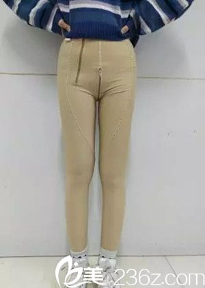 大腿吸脂手術(shù)一周后 大腿吸脂手術(shù)一周后