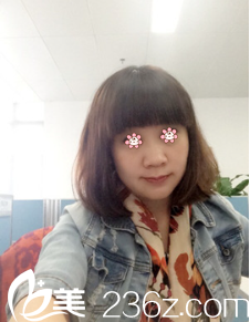 貴陽(yáng)美貝爾埋線(xiàn)提升術(shù)后一個(gè)月 貴陽(yáng)美貝爾埋線(xiàn)提升術(shù)后一個(gè)月