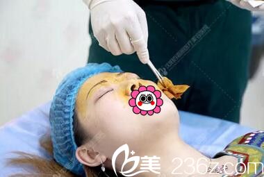 注射隆鼻術前消毒 注射隆鼻術前消毒