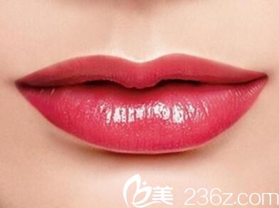 注射豐唇的材料選擇