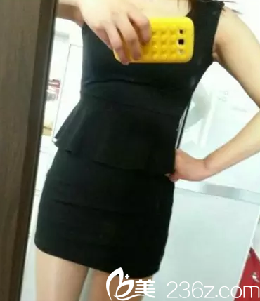 術(shù)后30天腰部明顯變瘦