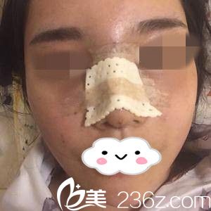 術(shù)后當(dāng)天 術(shù)后當(dāng)天