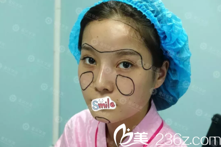 術(shù)前的笑笑 術(shù)前的笑笑