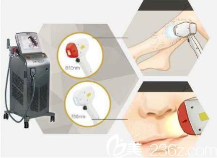 超冰的脫毛方法