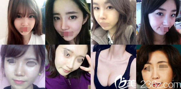 青?？等A塑美案例