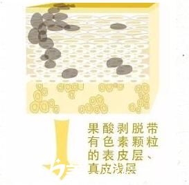 果酸換膚原理