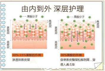果酸換膚技術(shù)